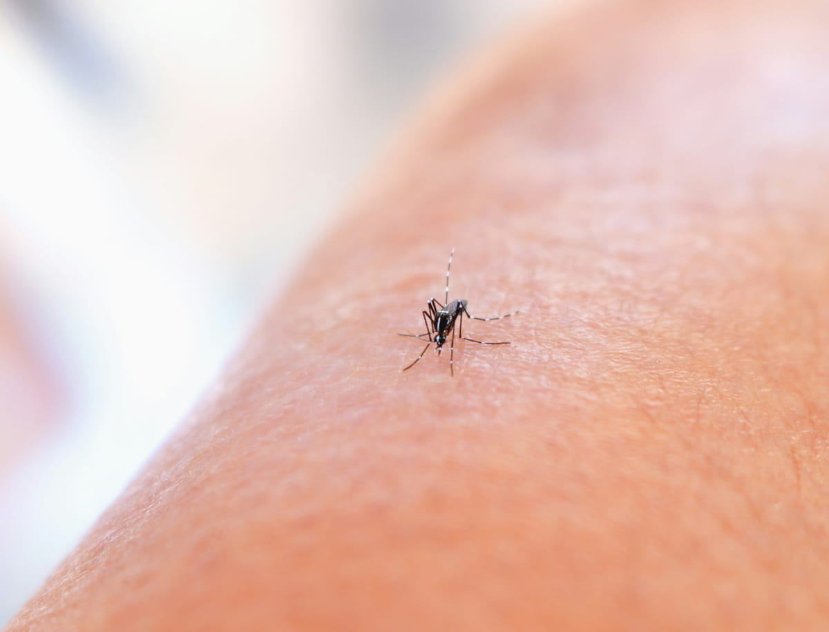Close-up of mosquito bite, relevant to understanding Jamaica’s mosquito presence.